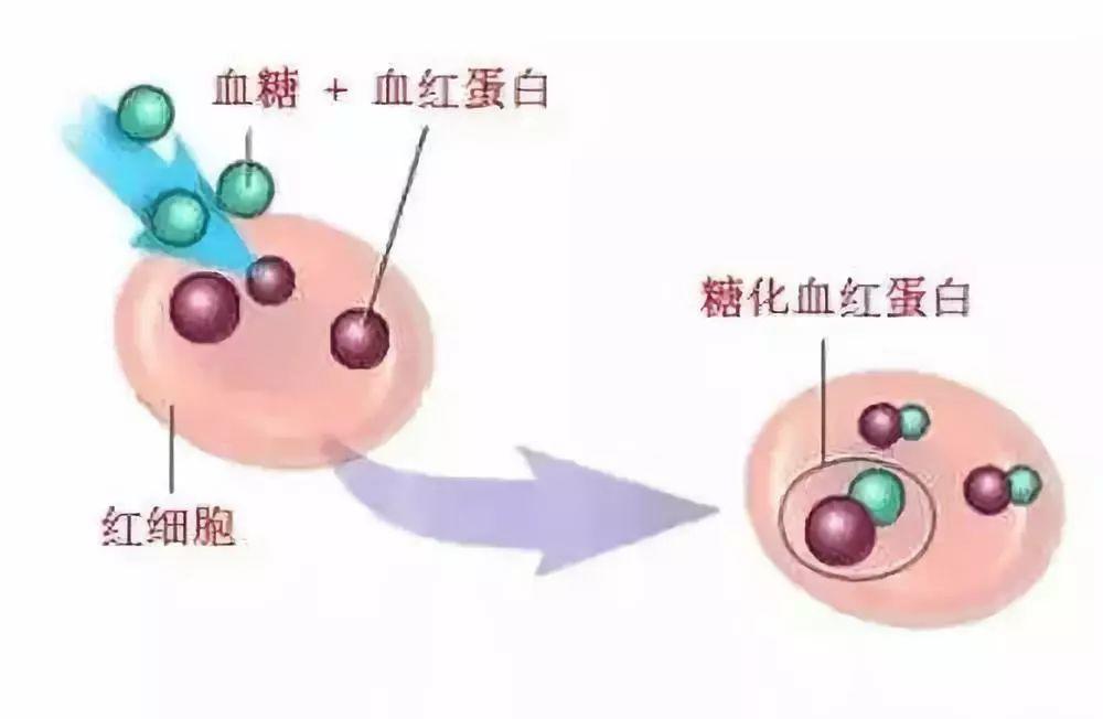 重磅！糖尿病降糖标准变了，你必须知道这些-第2张图片-爱来健康