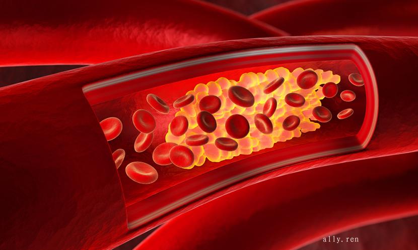 坏胆固醇指数愈低愈好？先认识「低密度脂蛋白」-第2张图片-爱来健康