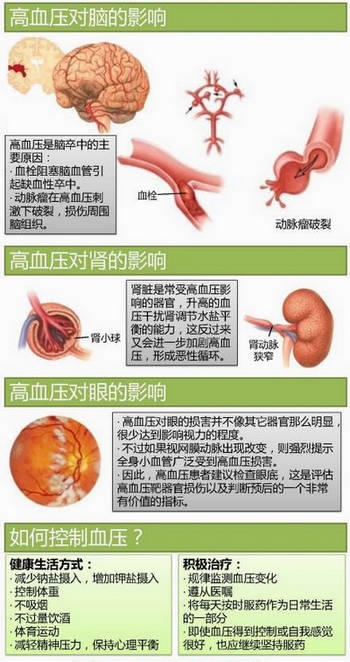 15张高血压医学美图，一文搞定高血压！-第6张图片-爱来健康