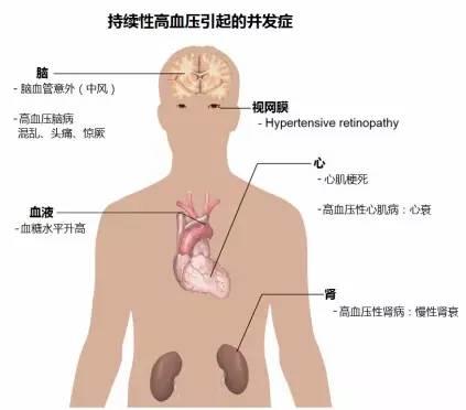 15张高血压医学美图，一文搞定高血压！-第4张图片-爱来健康