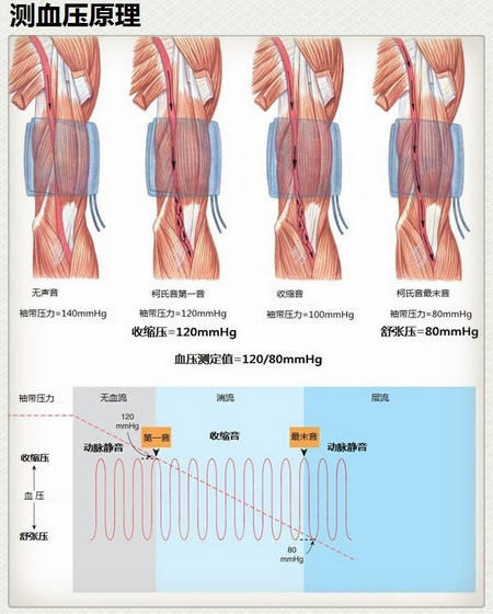 15张高血压医学美图，一文搞定高血压！-第14张图片-爱来健康