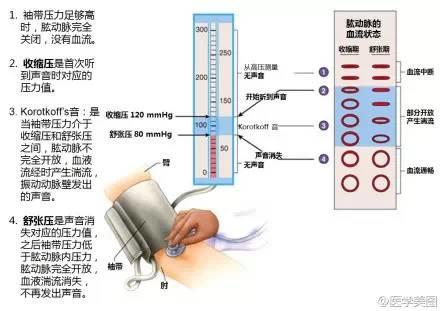 15张高血压医学美图，一文搞定高血压！-第16张图片-爱来健康