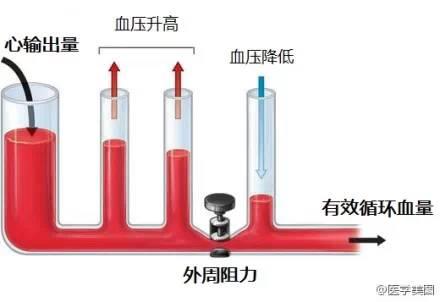 15张高血压医学美图，一文搞定高血压！-第11张图片-爱来健康