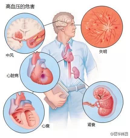 15张高血压医学美图，一文搞定高血压！-第7张图片-爱来健康