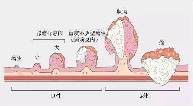 「黑豹」去世！死亡来得总是如此突然……-第33张图片-爱来健康