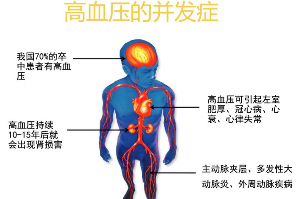 高血压生活管理指南，涉及方方面面！收藏！-第1张图片-爱来健康