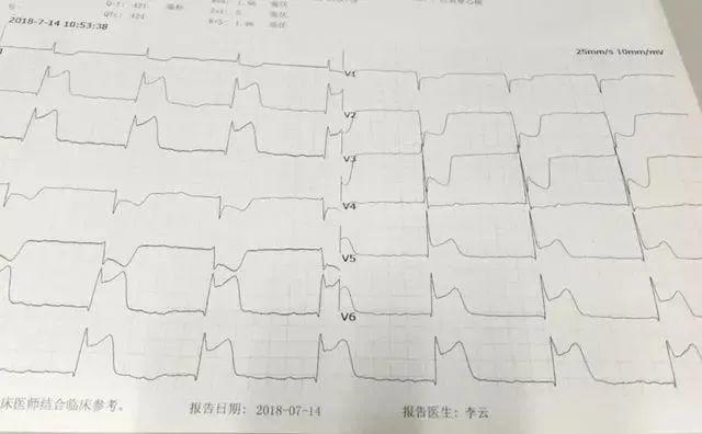 心内科医生整理的7个心梗教训，很多人都是被自己坑死的-第4张图片-爱来健康