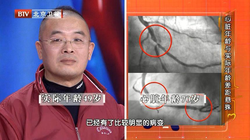 平均心脏年龄比实际年龄“老8岁”！5种行为最伤心，尤其是第3个-第2张图片-爱来健康