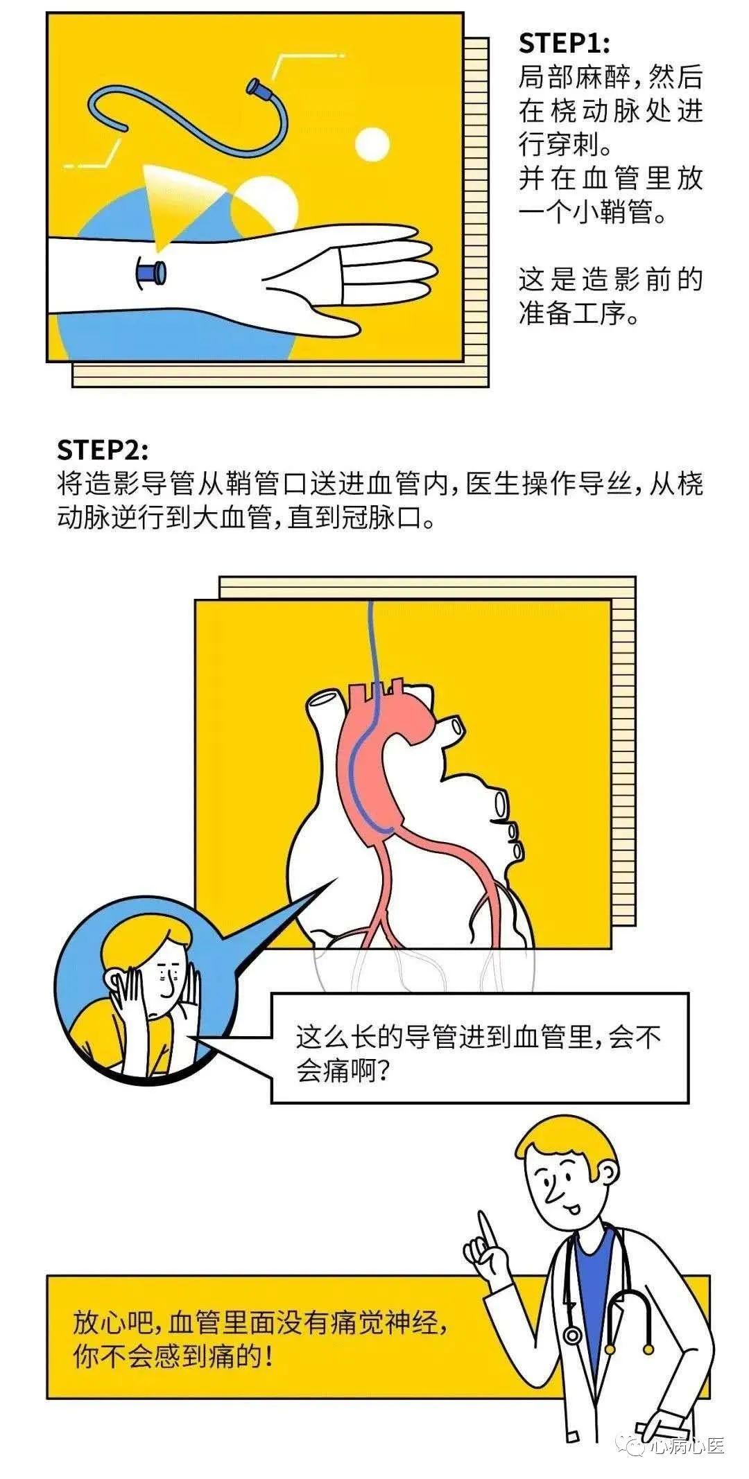 一台完整的PCI手术是如何完成的？-第2张图片-爱来健康