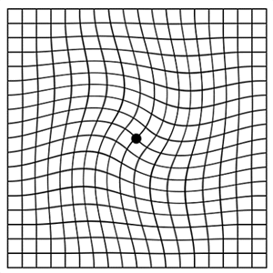 眼睛杀手黄斑部病变自我检查-阿姆斯勒方格(AMSLER GRID)-第2张图片-爱来健康