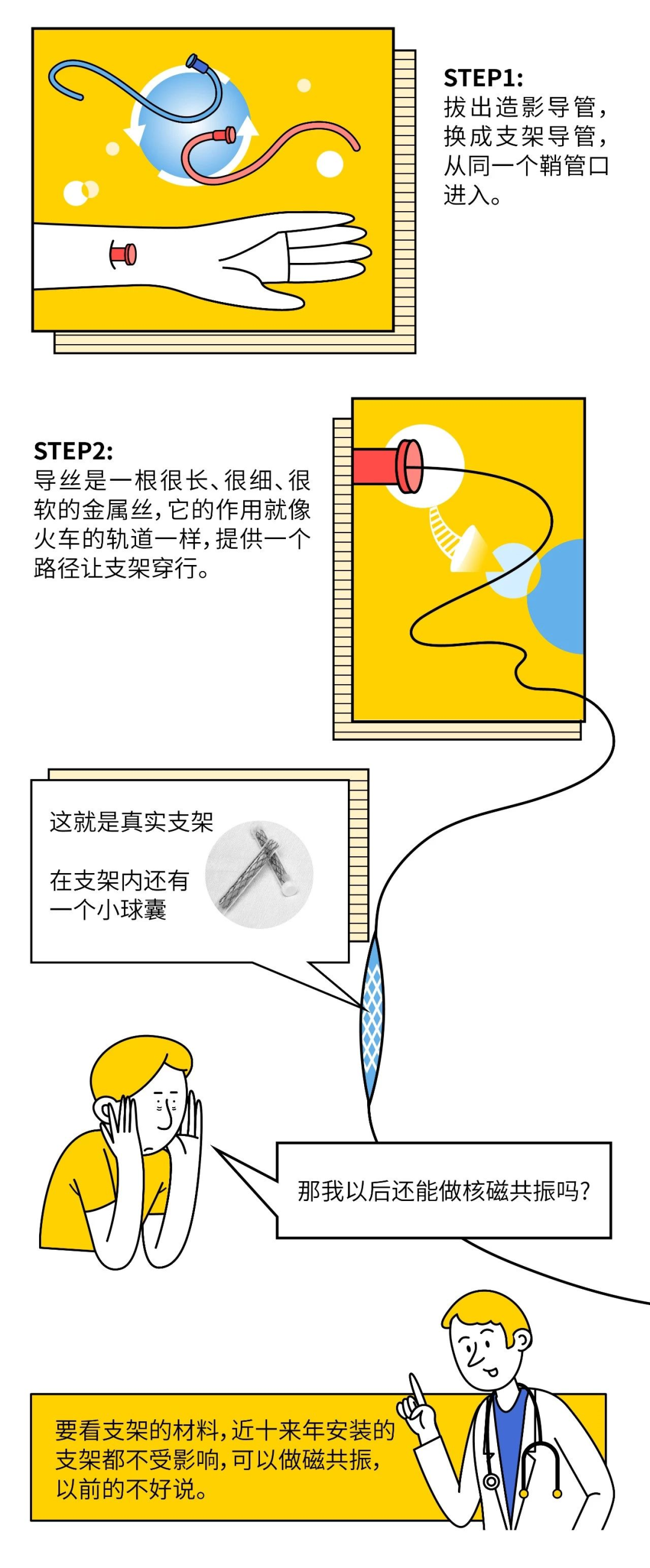 心脏支架是怎么装进去的？看完漫画你就全明白了-第4张图片-爱来健康